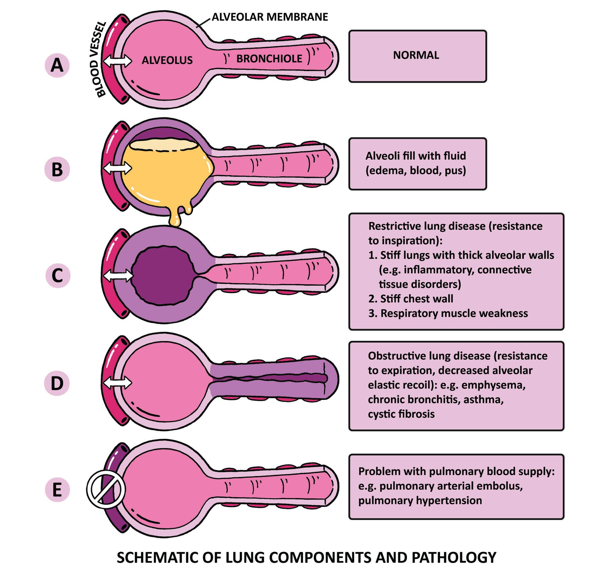 Clinical Pathophysiology Made Ridiculously Simple