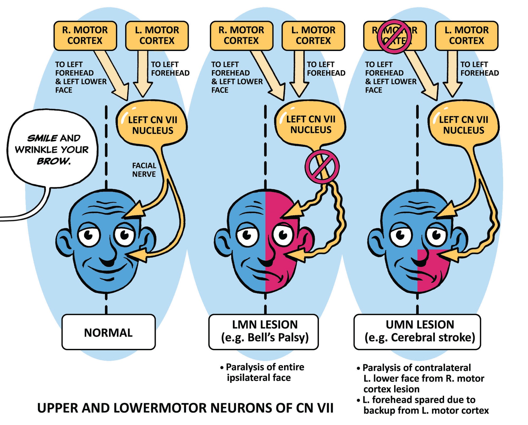 Clinical Pathophysiology Made Ridiculously Simple