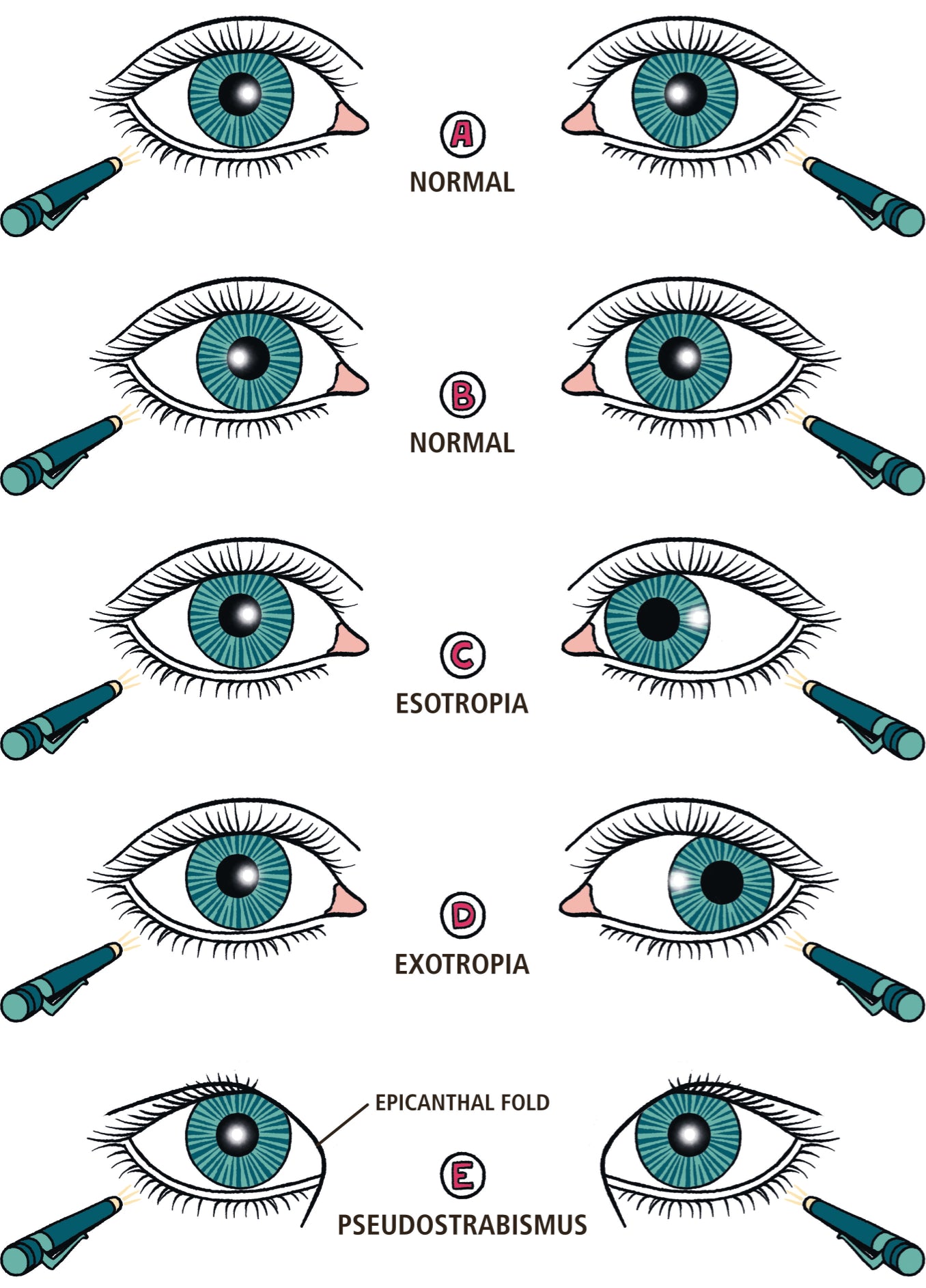 Ophthalmology Made Ridiculously Simple: Color Edition