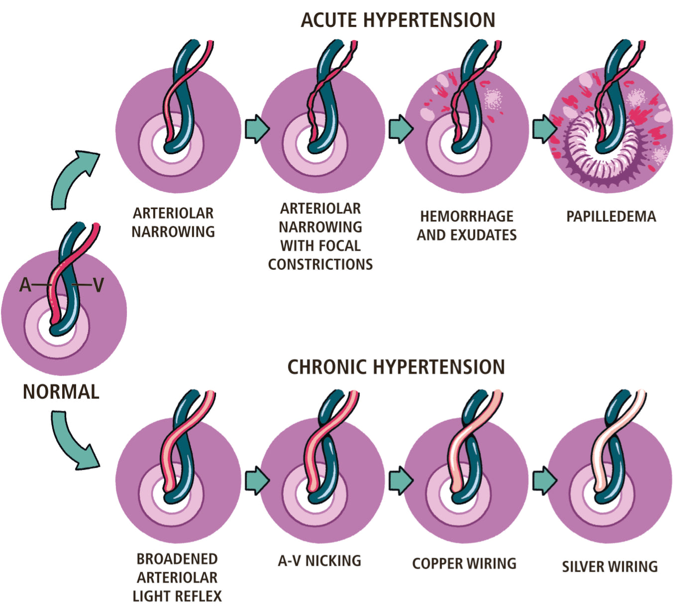 Ophthalmology Made Ridiculously Simple: Color Edition