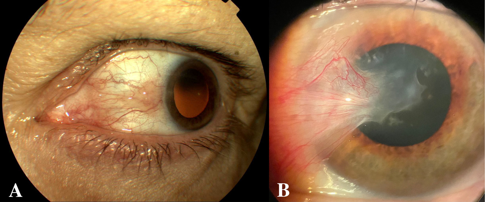 Ophthalmology Made Ridiculously Simple: Color Edition