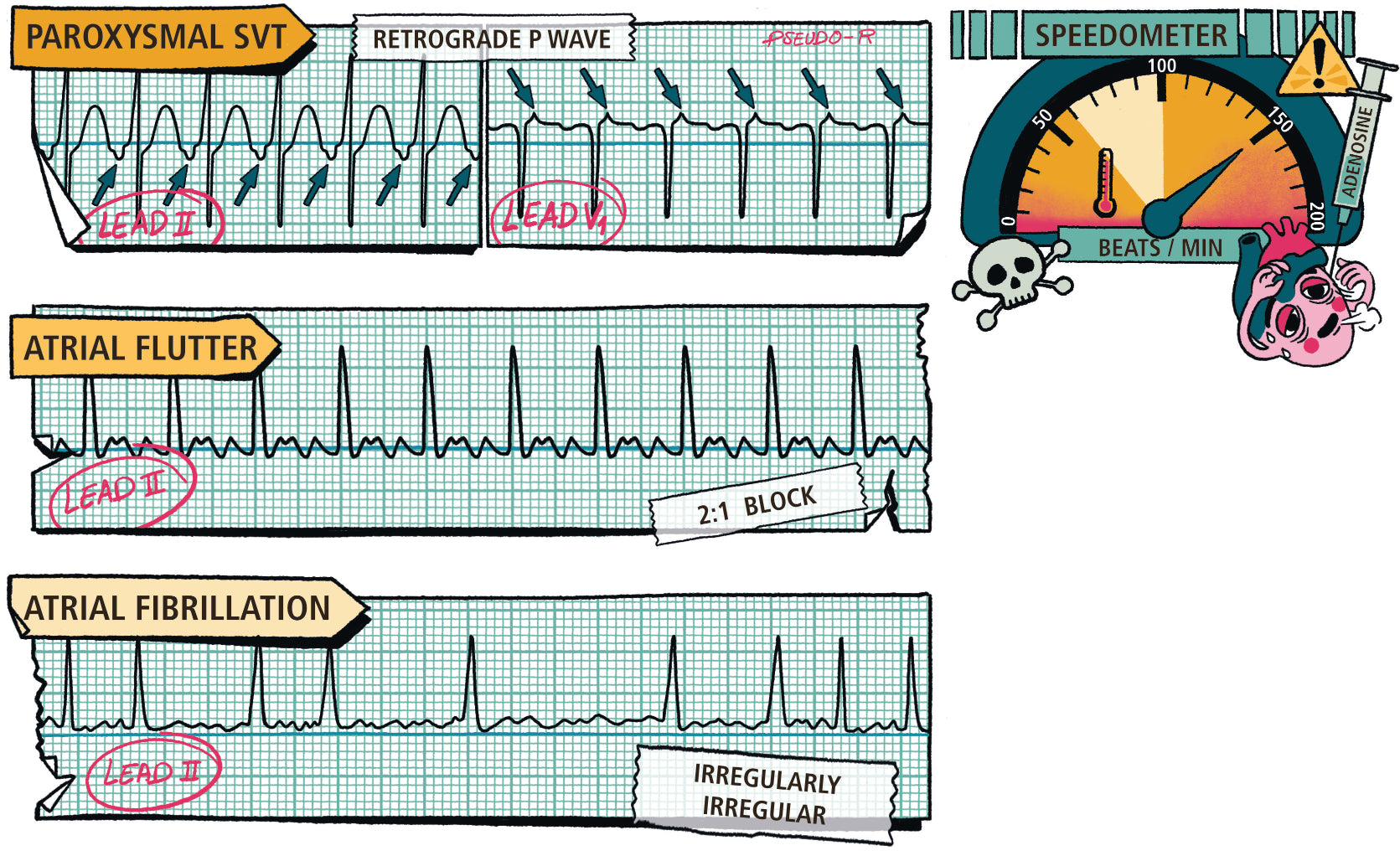 Critical Care and Hospitalist Medicine Made Ridiculously Simple