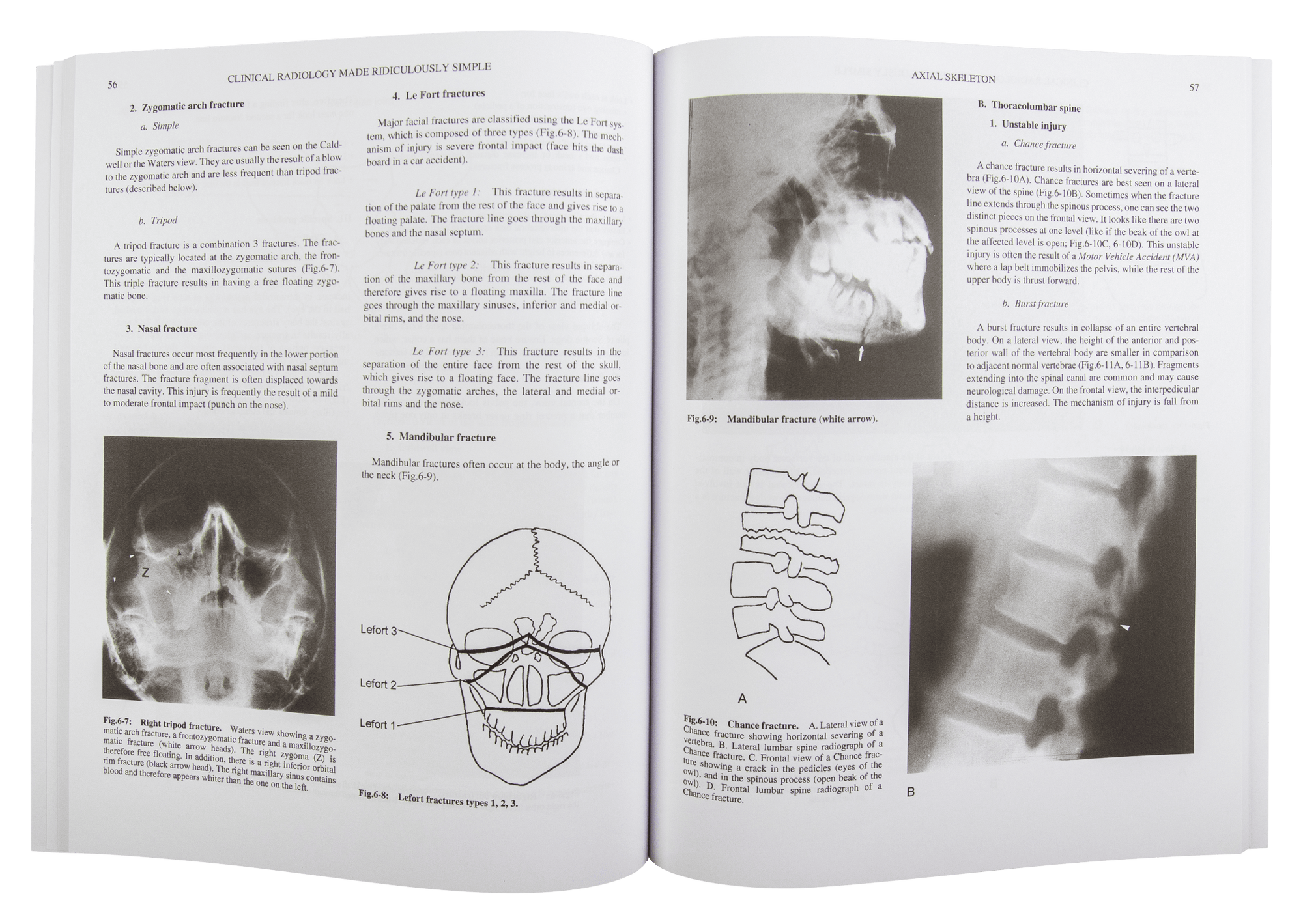 Clinical Radiology Made Ridiculously Simple - MedMaster