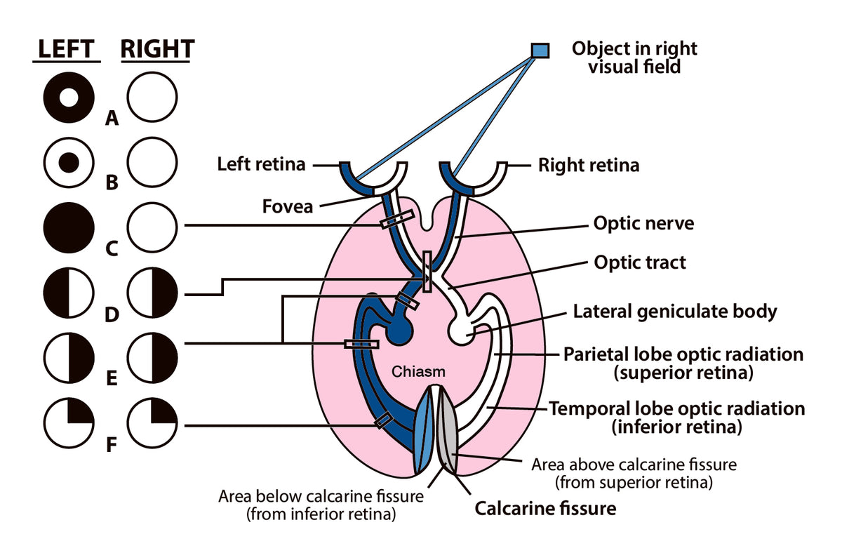 The Four-Minute Neurologic Exam