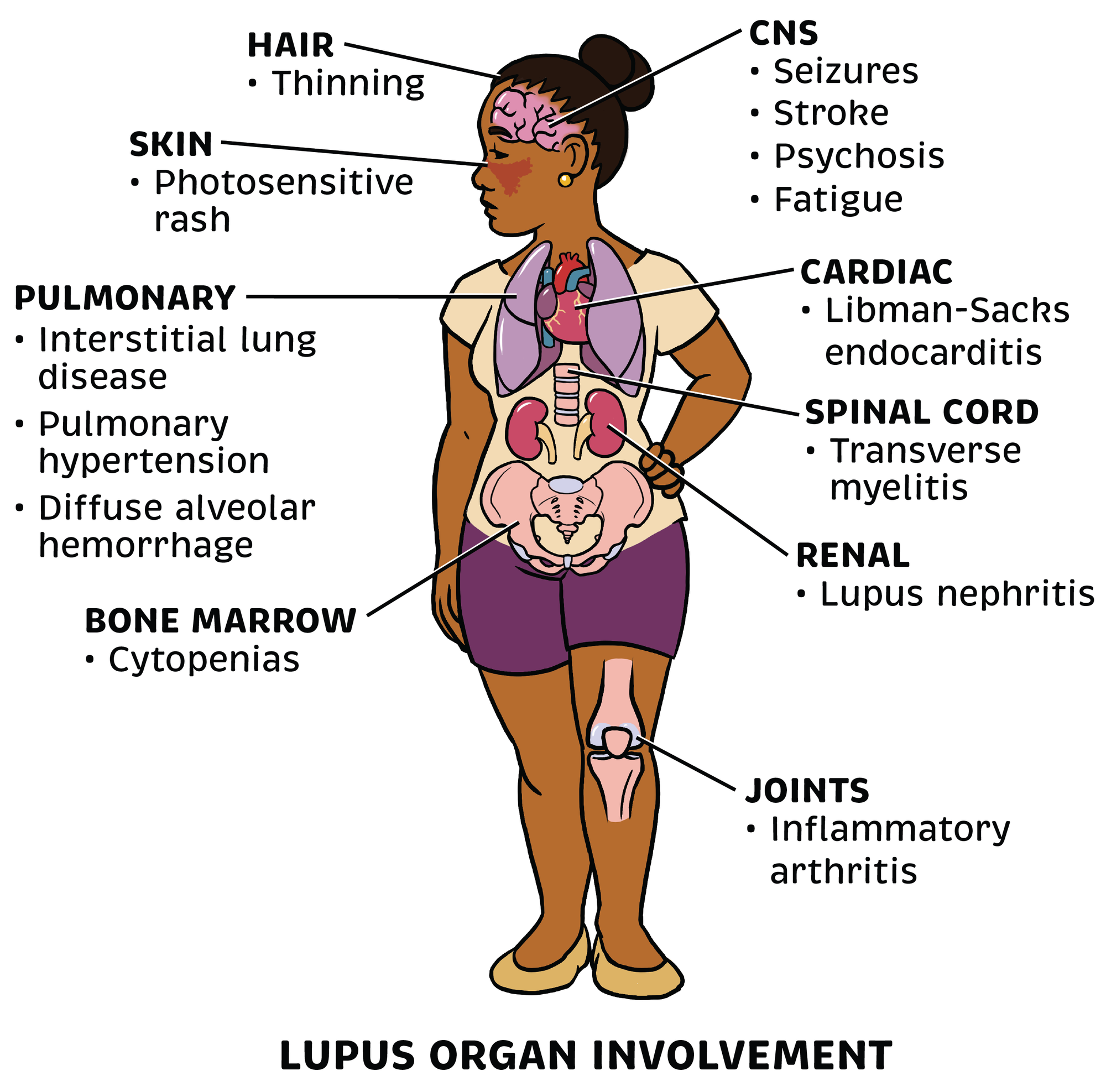 Rheumatology Made Ridiculously Simple