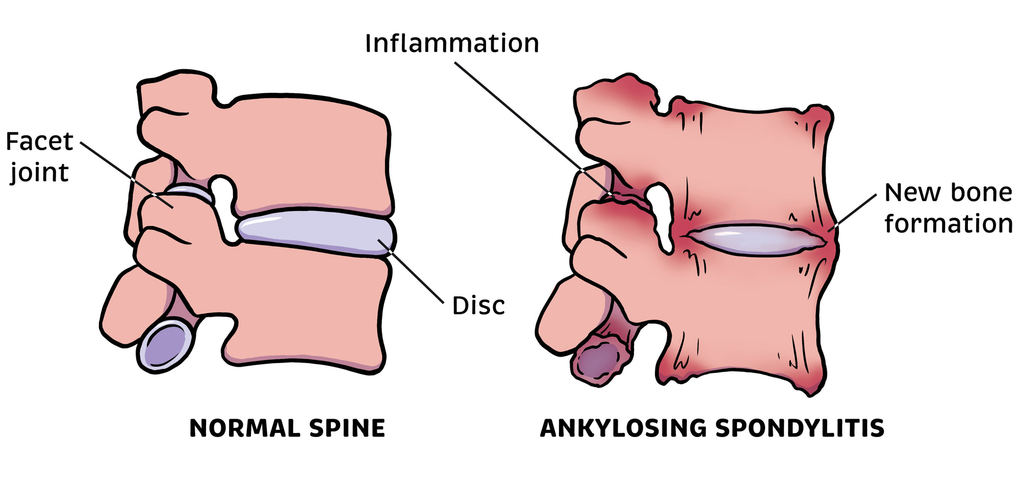 Rheumatology Made Ridiculously Simple