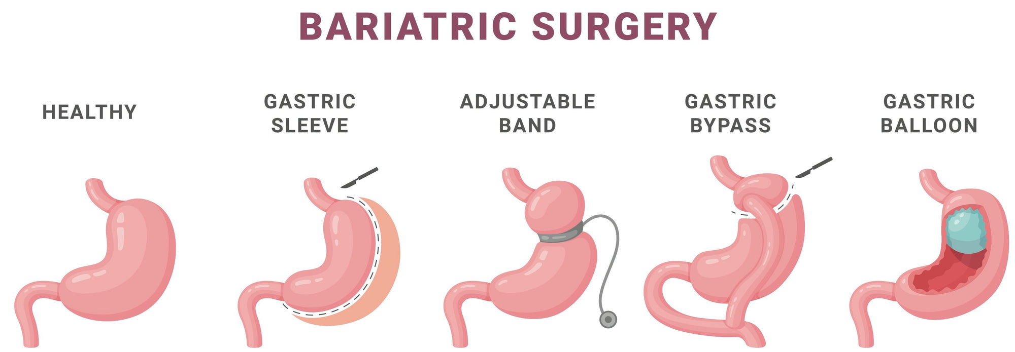 Gastroenterology Made Ridiculously Simple
